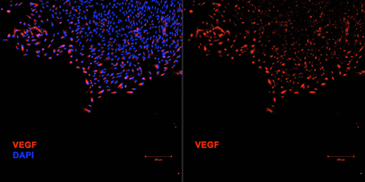 VEGF expression at corners of micropatterns