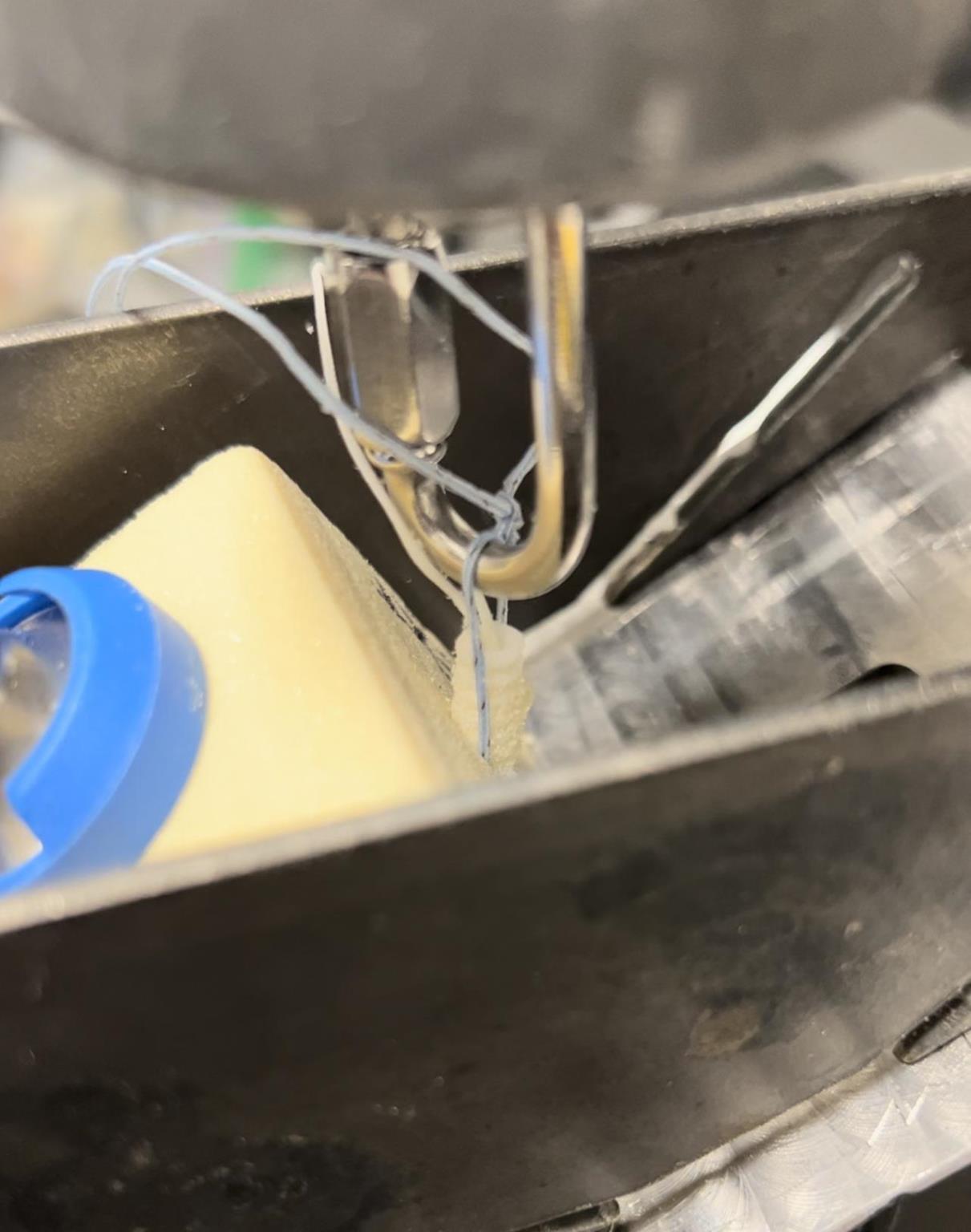 Figure 1: Suture Anchor Repair Failure