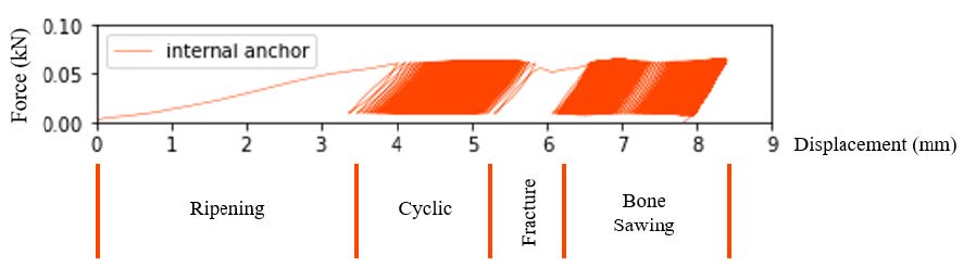 Figure 5: All Biomechanical Failure Modes of Suture Anchors in Osteoporotic Bone Displayed